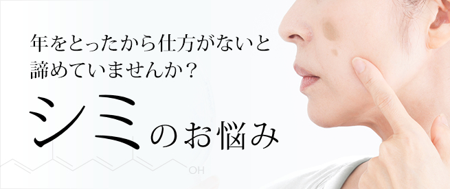歳をとったら仕方がないと諦めていませんか？シミのお悩み